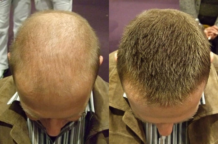 Männer haaren frisuren wenig mit Kurze Haare